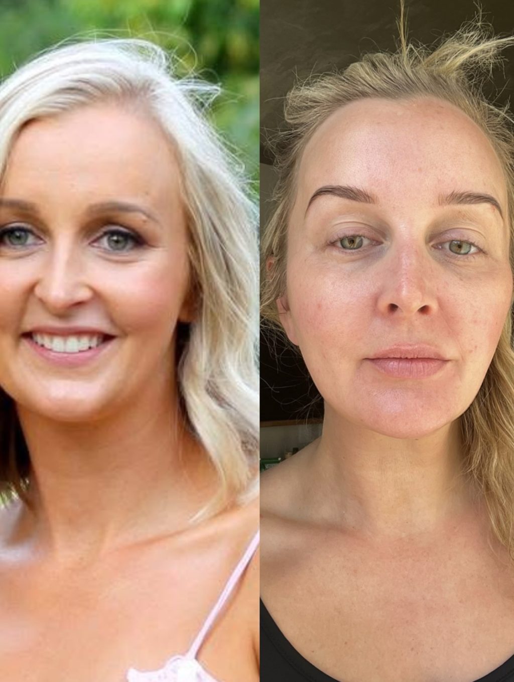 Instagram post from lumeskinclinicbendigo. This post is in position 1.