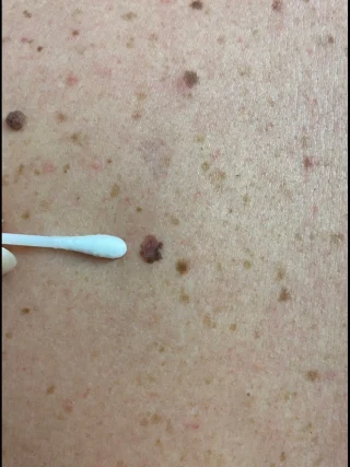 Instagram post from lumeskinclinicbendigo. This post is in position 2.